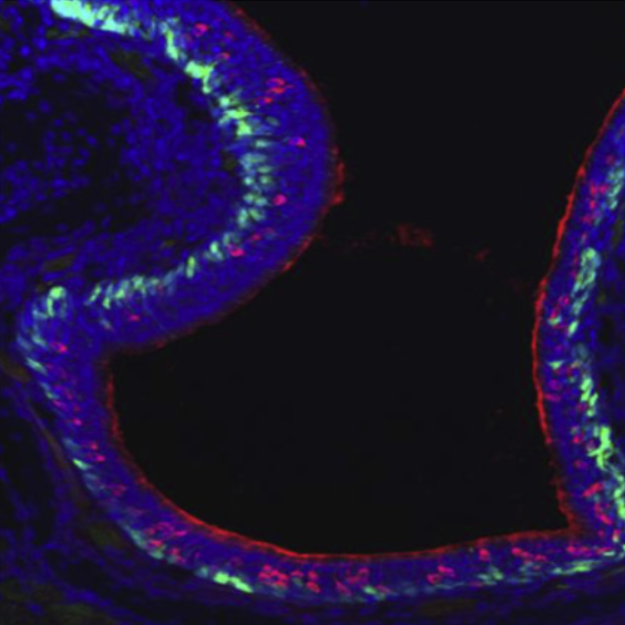 Magklara_Cell_11