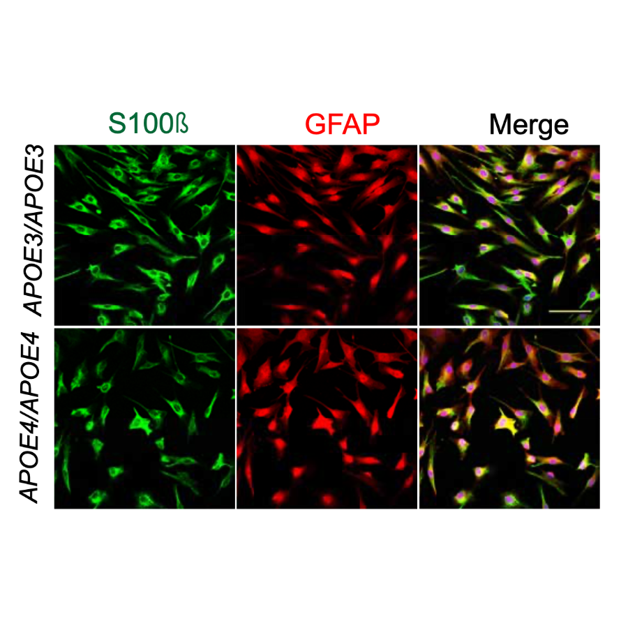 Sienski_ScienceTranslationalMedicine_21.png